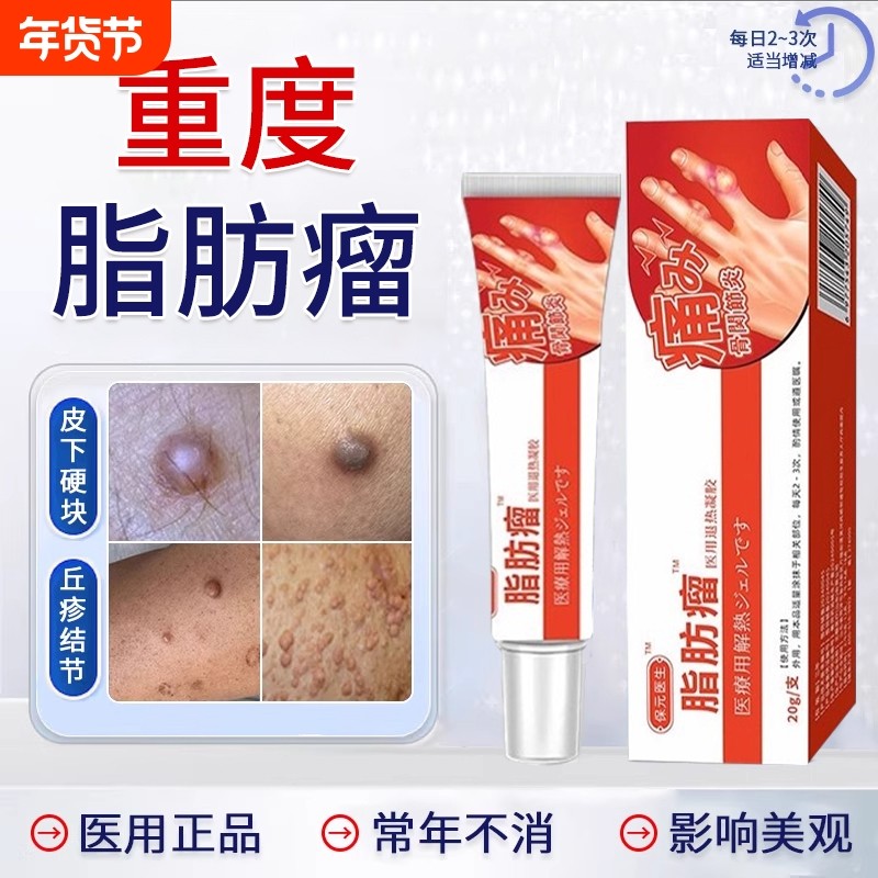 皮肤纤维瘤膏皮下脂肪正瘤消瘤手指肿胀变形凝胶保元制药特肿硬块,医疗器械,膏药贴（器械）,淘宝优惠券,粉丝福利购,淘宝优惠卷