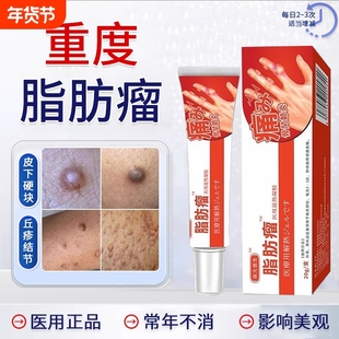 皮肤纤维瘤膏皮下脂肪正瘤消瘤手指肿胀变形凝胶保元制药特肿硬块