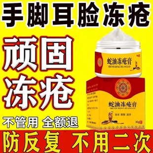 冻疮膏止冻痒冻伤膏正品排行榜第一名特效冬天脸手足药保湿滋润