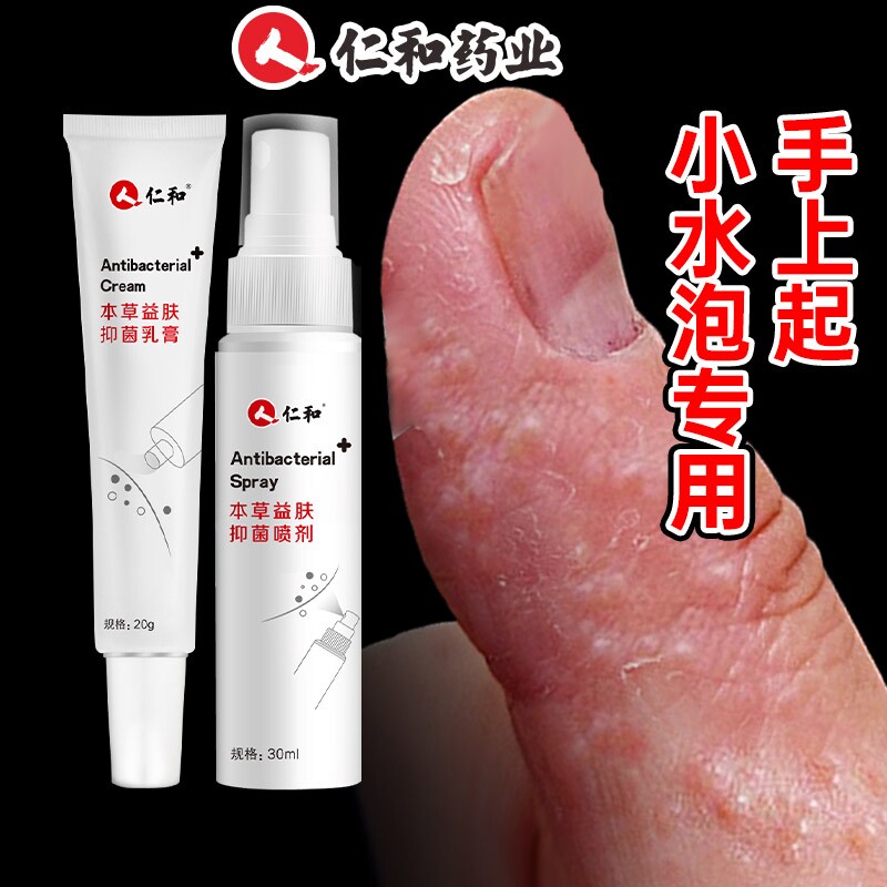 手上起小水泡手痒指长非汗状疱疹专用软膏止痒汗包膏汗泡膏汗孢疹