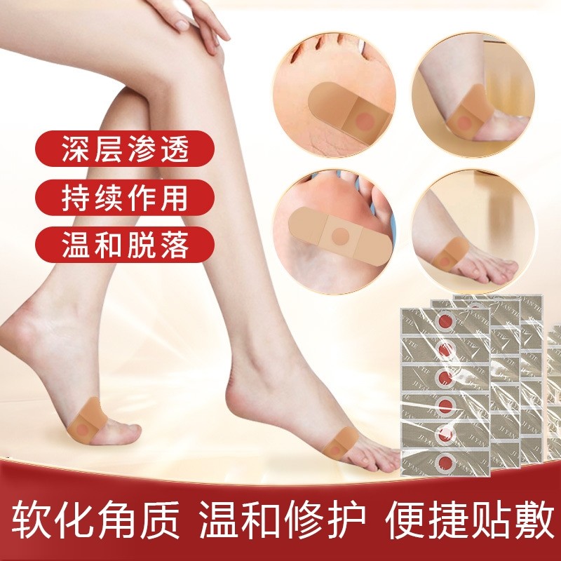 鸡眼贴去鸡眼老茧死皮肉刺跖疣瘊子脚茧鸡尤康贴手足部棉签小巧