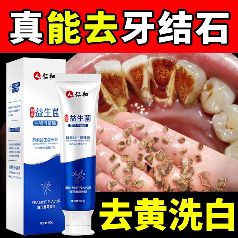 牙膏去黄益生菌正品去除牙结石垢非男士专用口臭旗舰店防蛀固齿