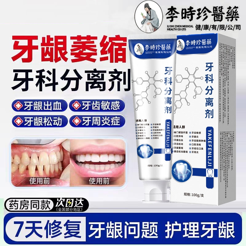 李时珍牙龈伸缩牙齿松动分离剂