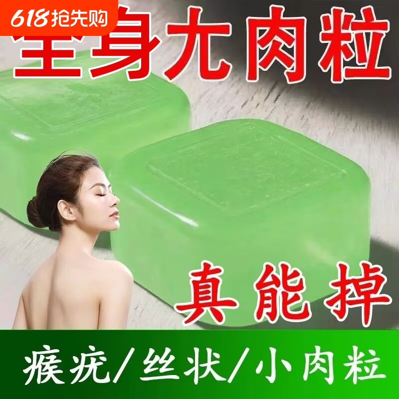 祛疣皂去小肉粒扁平瘊疣丝状洗脸护肤康尤皂男女国药草本古法植物