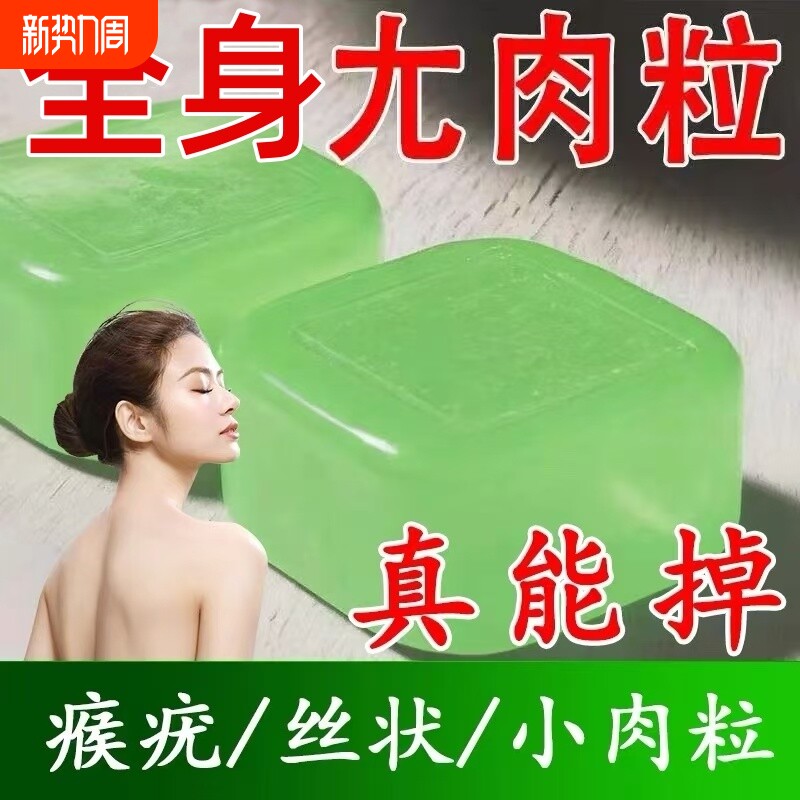 祛疣皂去小肉粒扁平瘊疣丝状洗脸护肤康尤皂男女国药草本古法植物