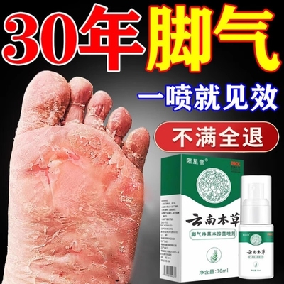 云南本草脚气喷雾止痒脱皮杀菌去真菌感染专用根糜烂脚趾缝臭水泡