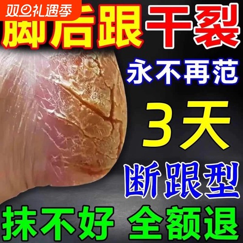 皲裂膏脚后跟干裂修复霜起硬皮专治足跟开裂脱皮脚裂脚跟真菌感染