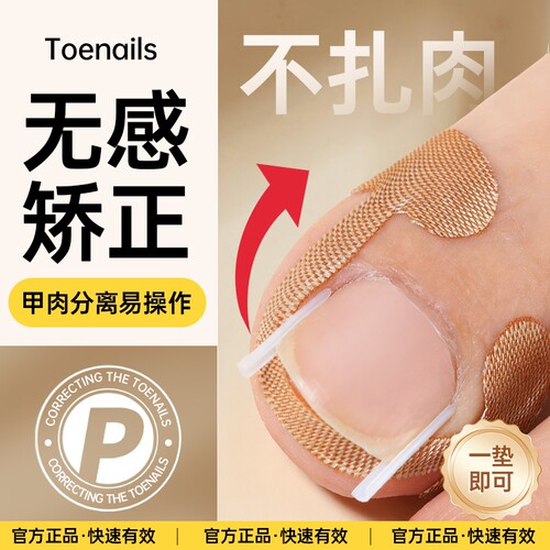 甲沟神器指甲矫正器嵌甲专用拉贴隔离脚趾甲长肉里填充垫片纠正炎