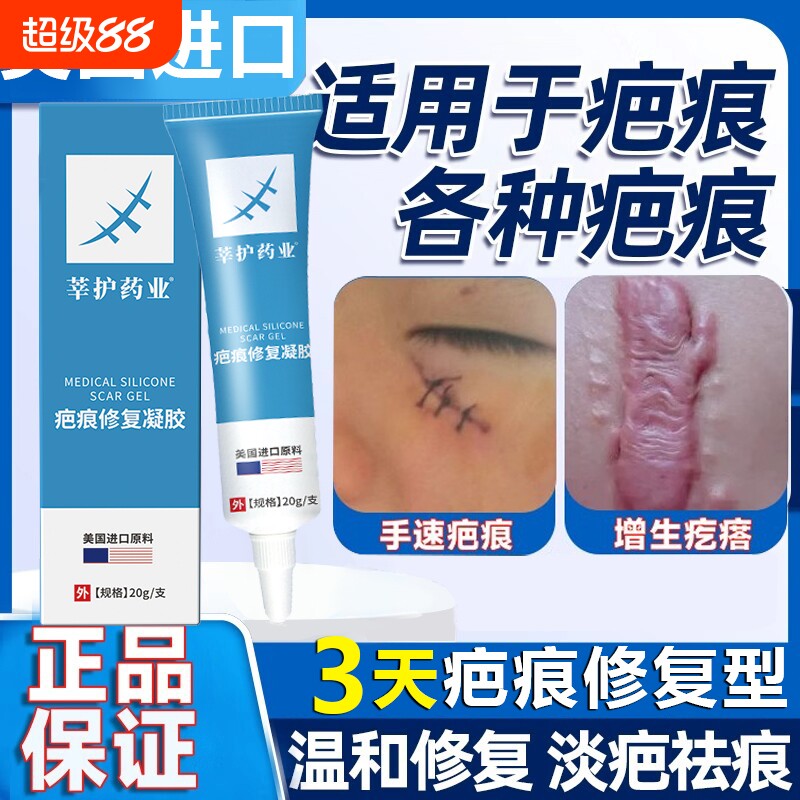 巴克疤克祛疤膏疤痕修复去除疤凝胶增生凸起疙瘩正品官方旗舰店图片