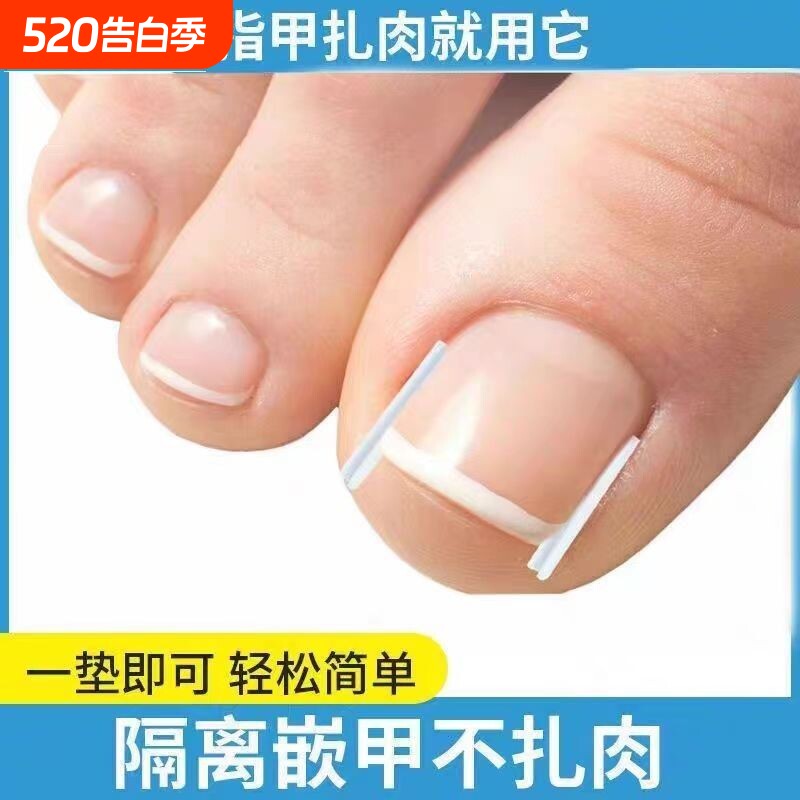 甲沟垫嵌甲指甲矫正器填充垫片正甲贴脚趾甲长肉里专用修甲刀棉花