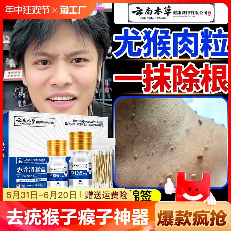 去除尤疣瘊猴子瘊子祛除神器肉粒疙瘩一抹无忧脖子上长小肉粒药膏