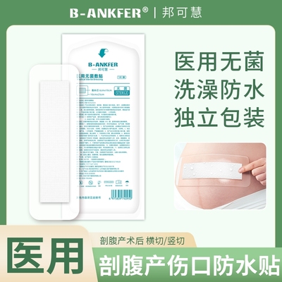 医用无菌敷贴剖腹产术后伤口敷料