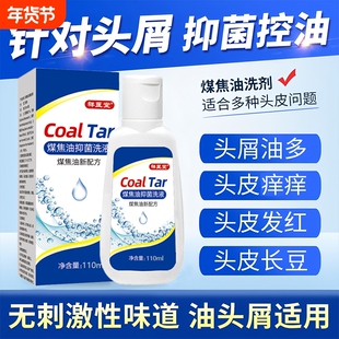 煤焦油洗剂官方旗舰店正品医用脂溢性炎皮去屑痒止马拉色健康抑菌