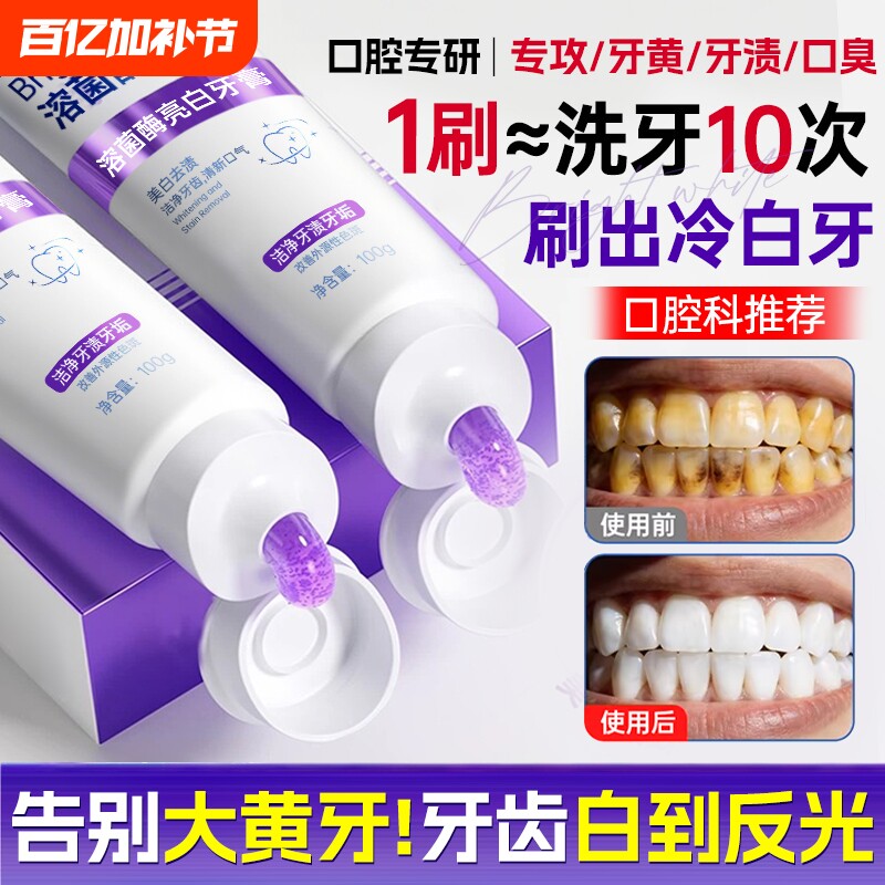 牙膏美白去黄去口臭除异味口气清新速效洗白女男专用成人正品官方