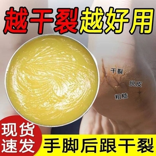 香港脚后跟干裂修复霜手足龟裂开裂治起皮去死皮润马油皱裂膏