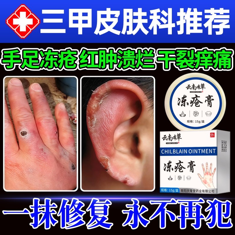 云南本草冻疮膏止痒冻伤膏正品官方旗舰店防冻裂手足冻耳朵伤消肿,保健用品,皮肤消毒护理（消）,淘宝优惠券,粉丝福利购,淘宝优惠卷