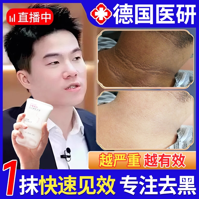 脖子黑色素去除黑棘皮症脖子黑色素沉淀洗不干净肥胖儿童美白神器