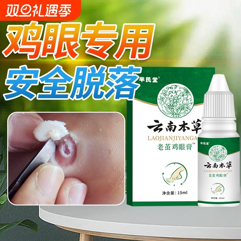 抑菌云南本草老茧鸡眼膏贴鸡眼贴正品去脚底肉刺鸡眼膏去除液草本