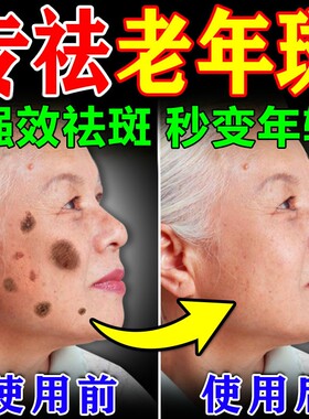 老年斑美白祛斑霜黄褐专用膏药强力去手部除脸部一擦就掉中老年人