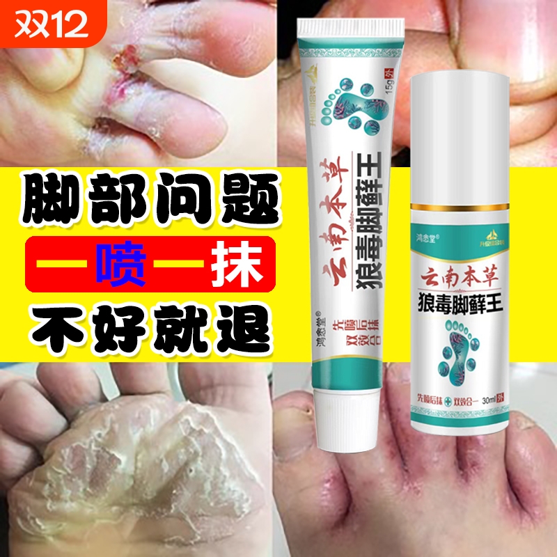云南本草狼毒脚藓王脚气脚痒脚臭脱皮水泡烂脚丫糜烂脚趾止痒乳膏