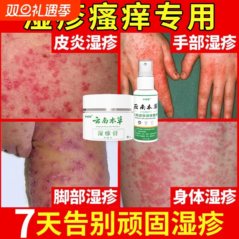 湿疹止痒去外用根肛门阴囊潮湿瘙痒私处睾丸痒皮肤肛周药膏男人