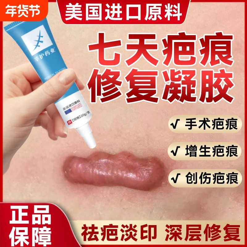 祛疤膏疤克去疤痕修复无痕除疤膏第一名医用巴克官方正品旗舰店