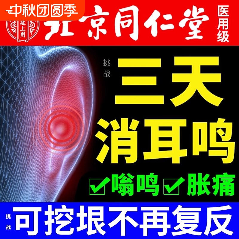 神经性耳鸣耳贴【胖东来热销】
