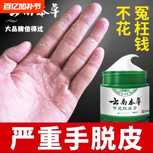 手足脱皮膏手指上真菌蜕皮干燥起皮童手掌蜕皮手心手脚掉皮褪专用