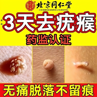 疣瘊肉粒一抹无忧官方旗舰店去除扁平疣丝状疣疙瘩立净药房膏退热