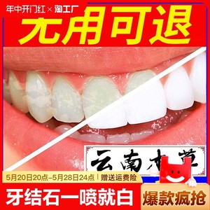 牙结石去除器溶解除牙石非速效漱口水洗牙齿污垢牙黄牙垢神器口臭