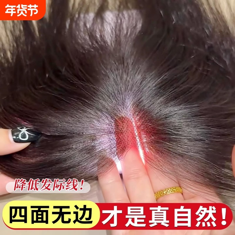 假发女片头顶增发量仿真高颅顶蓬松遮白发自然前额八字刘海补发片