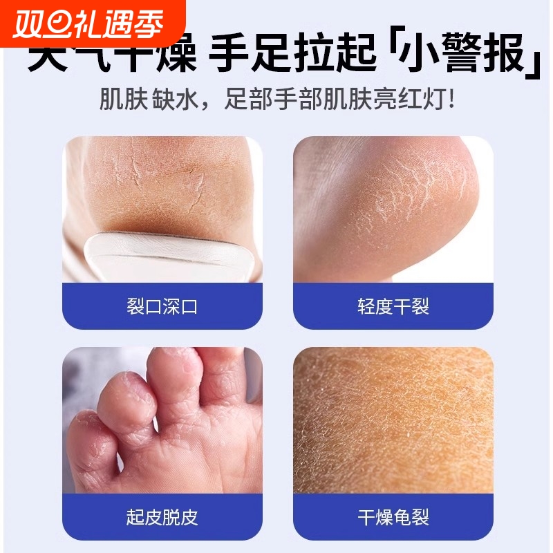 防裂膏手足干裂皴裂膏皲裂膏