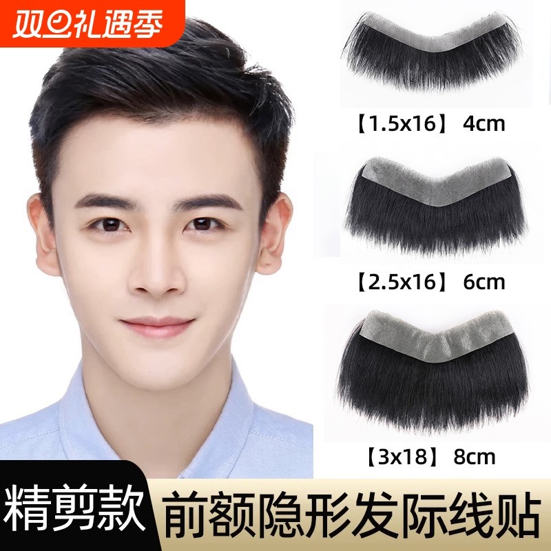 许尚发真人发丝前额补发送胶片