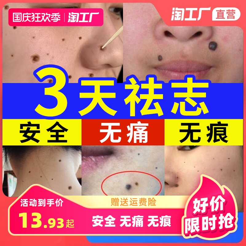 点痣膏无痕正品旗舰店祛痣脸部去淡斑非药水点斑水笔专用膏液家用使用感如何?