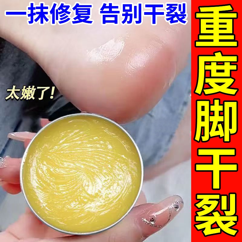 脚后跟干裂起硬皮足跟脚裂开裂真菌感染防皲裂保湿脱皮修复霜药