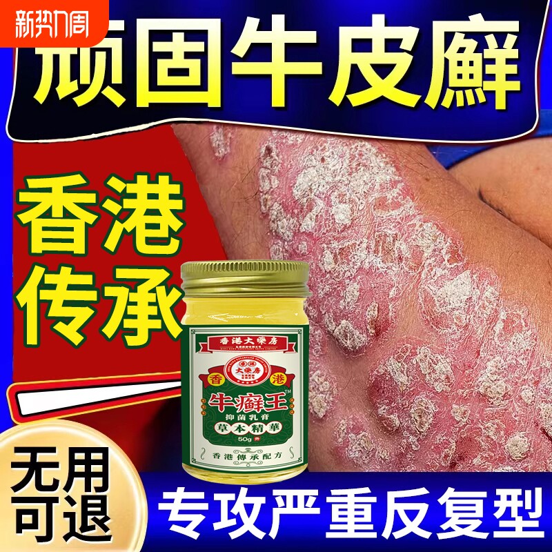 香港牛藓王治疗牛皮藓癣银屑专用膏去屑病皮肤杀菌症效痒特正品