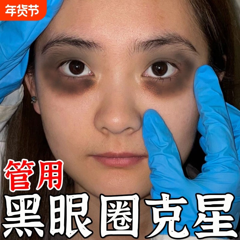 黑眼圈去除神器男女士视失眠疲劳特别严重熊猫眼罩艾草蒸汽热敷贴