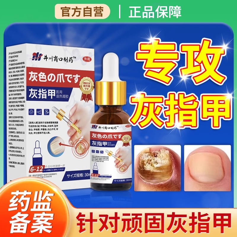 灰指甲药修复灰甲【销量No.I】