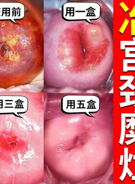 同仁堂专用消糜栓|103人收藏