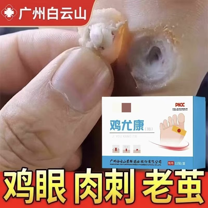 鸡眼贴去鸡眼神器老茧鸡贴眼脚钉祛除膏鸡茧眼足部鸡贴眼膏正品