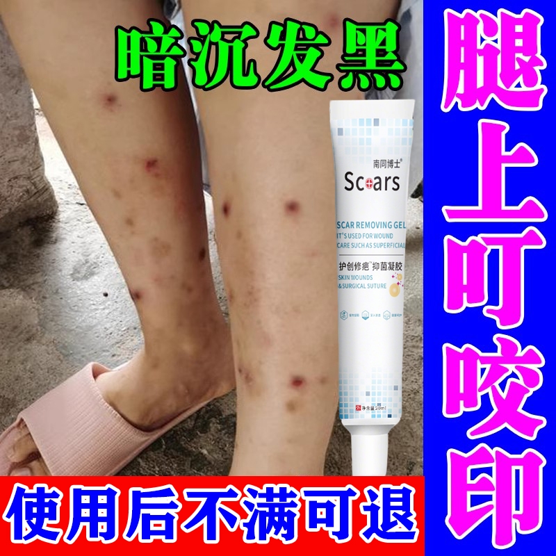 去蚊子虫叮咬疤痕印淡化黑印黑色素祛疤膏修复腿印挠印豆疤痘印