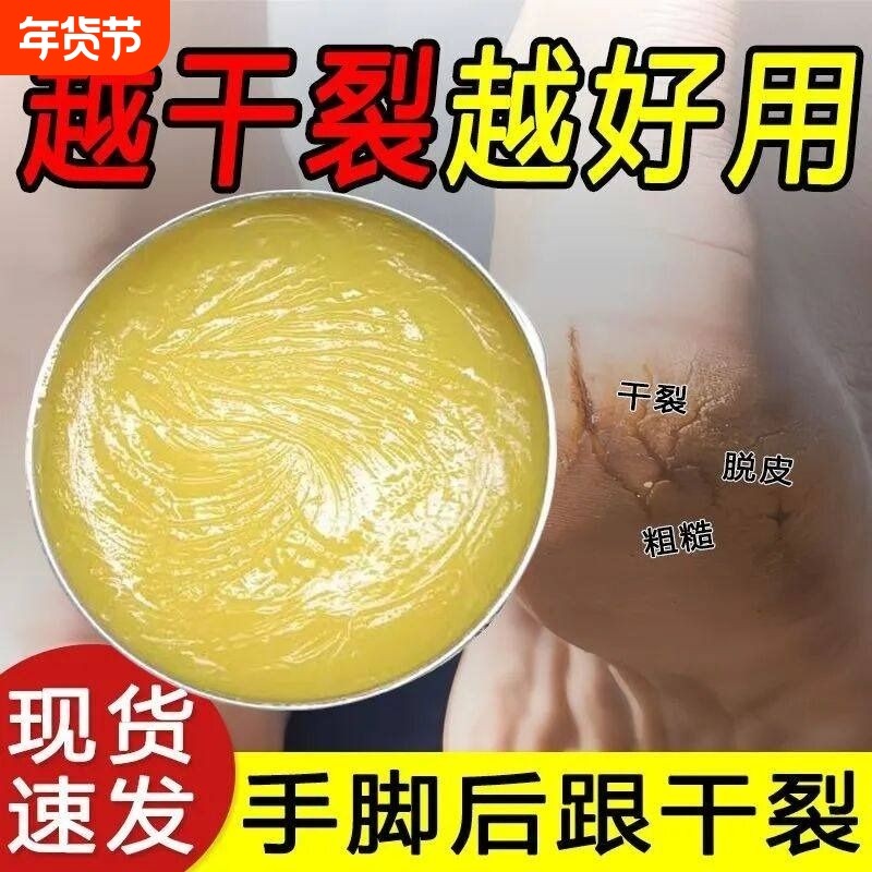 香港脚后跟干裂修复霜手足龟裂开裂治起皮去死皮润马油皱裂膏