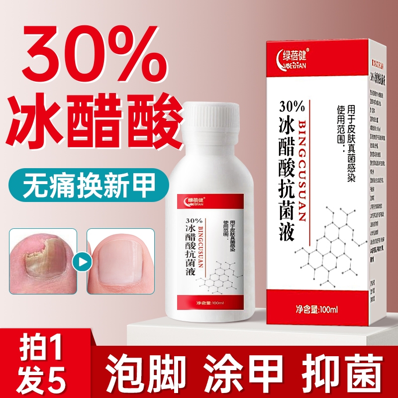 医用冰醋酸30灰指甲抗菌灰指甲抑菌液溶液涂剂杀菌泡脚旗舰店正品