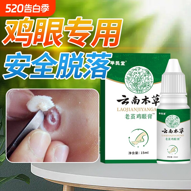 抑菌云南本草老茧鸡眼膏贴鸡眼贴正品去脚底肉刺鸡眼膏去除液草本