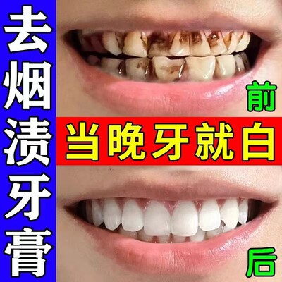 【全网爆款】去烟渍牙膏