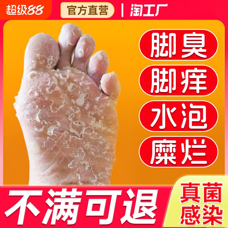 高锰酸钾泡脚溶液外用去真菌脚出汗杀菌消毒非医用脚部除臭浴足剂