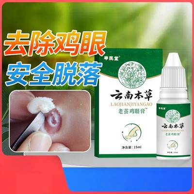 云南本草老茧鸡眼膏贴正品去脚底肉刺鸡眼贴鸡眼膏成膜去除液抑菌