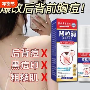 背粒消去祛痘后背除螨前胸去背上胸口屁股痘去除祛痘喷雾螨虫痘印