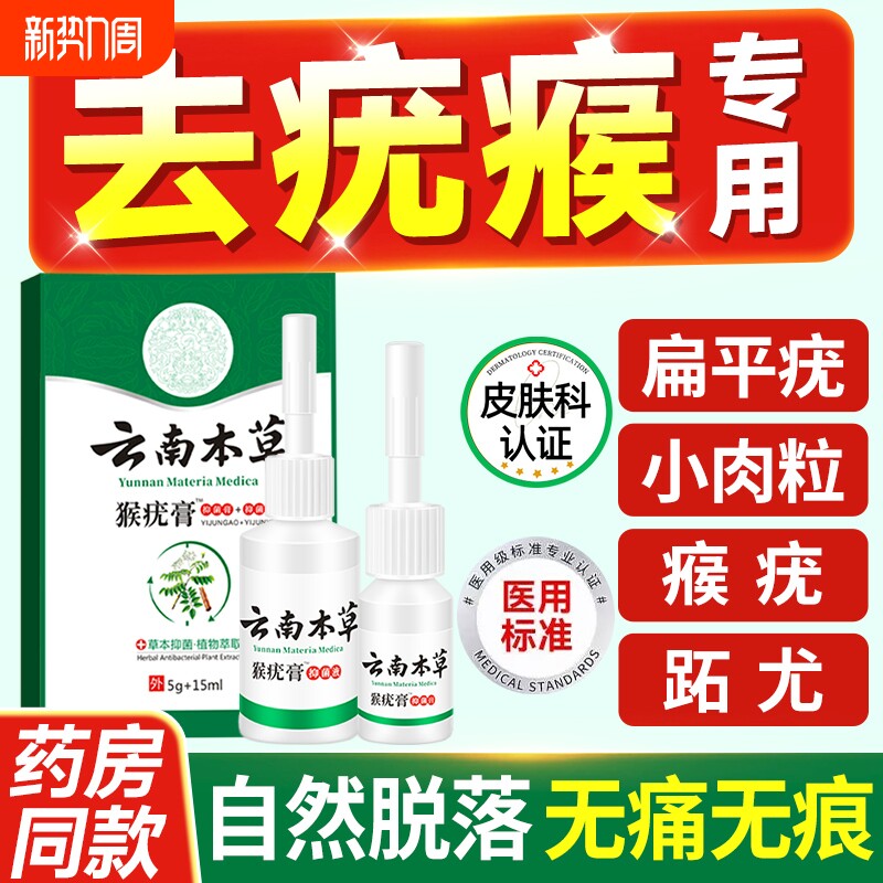 去除尤疣瘊猴子瘊子祛除神器脖子上长小肉粒疙瘩一抹无忧药膏一