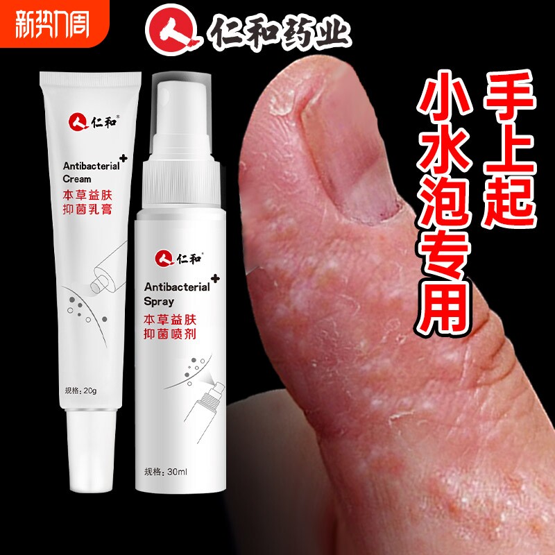 手上起小水泡手痒指长非汗状疱疹专用软膏止痒汗包膏汗泡膏汗孢疹
